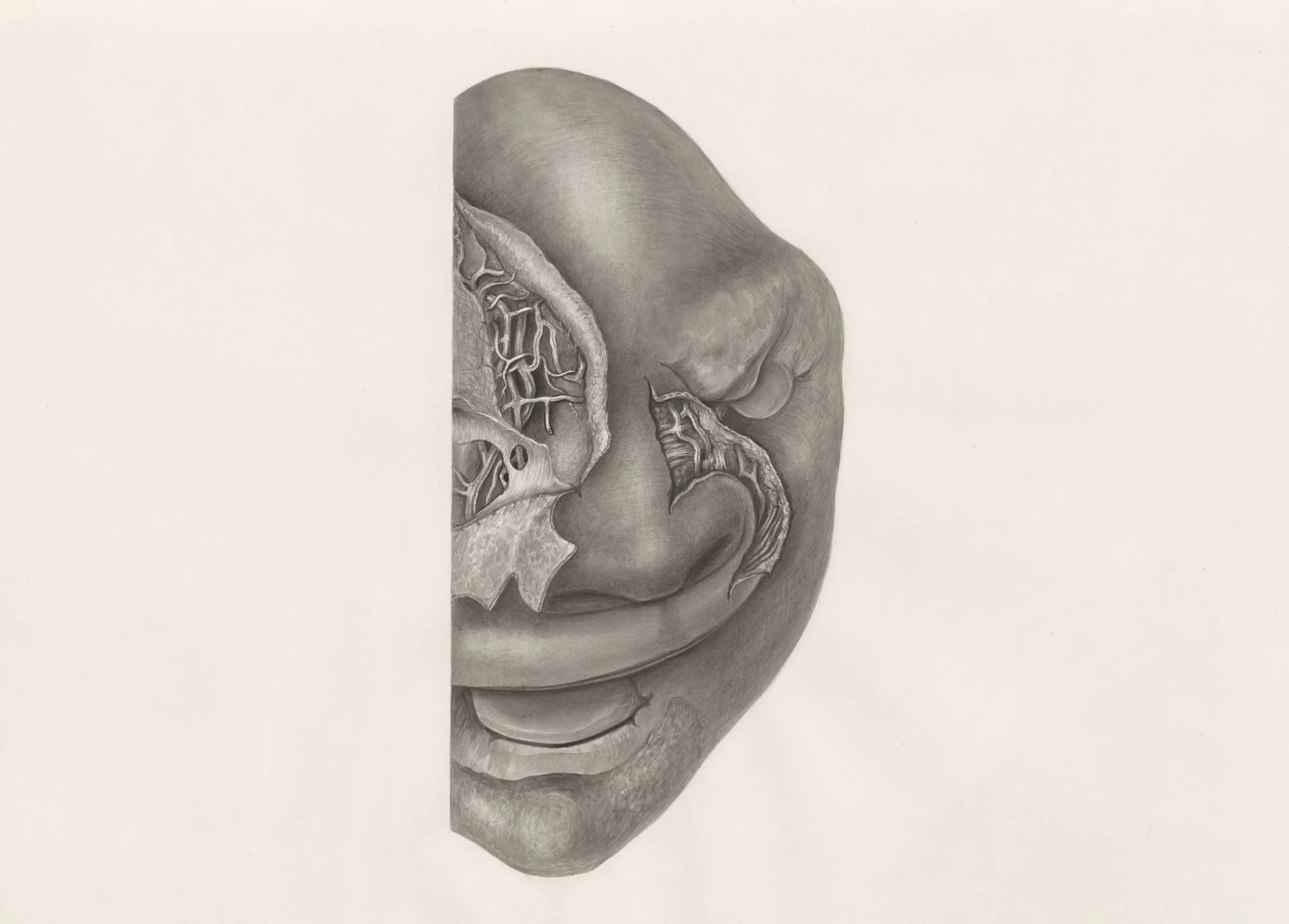 Deformed fetal head, partly seen from the front, detail