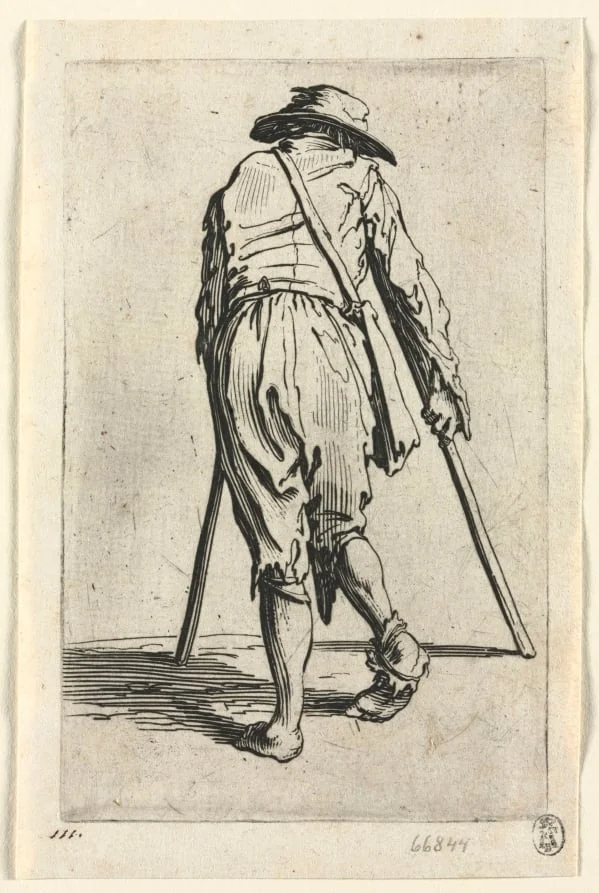 The Beggars: Beggar on Crutches, Wearing a Hat, detail
