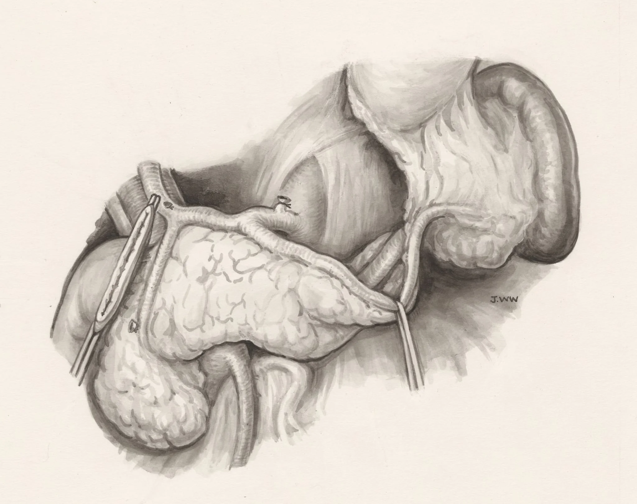 Operation on human tissue, detail