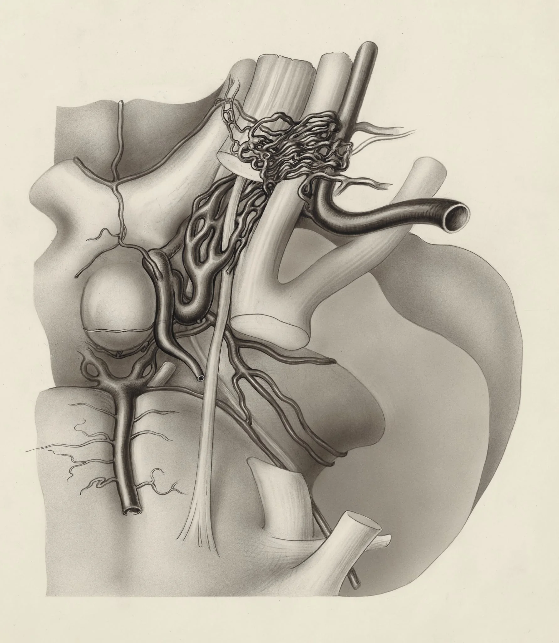 Nerves and other tissue of the neck and/or head, detail