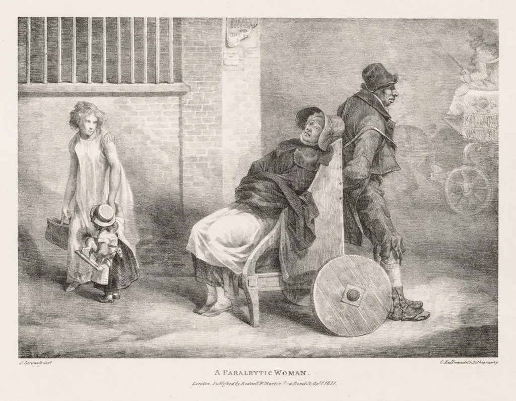 Various Subjects Drawn from Life and on Stone:  A Paraleytic Woman, by Théodore Géricault, 1821