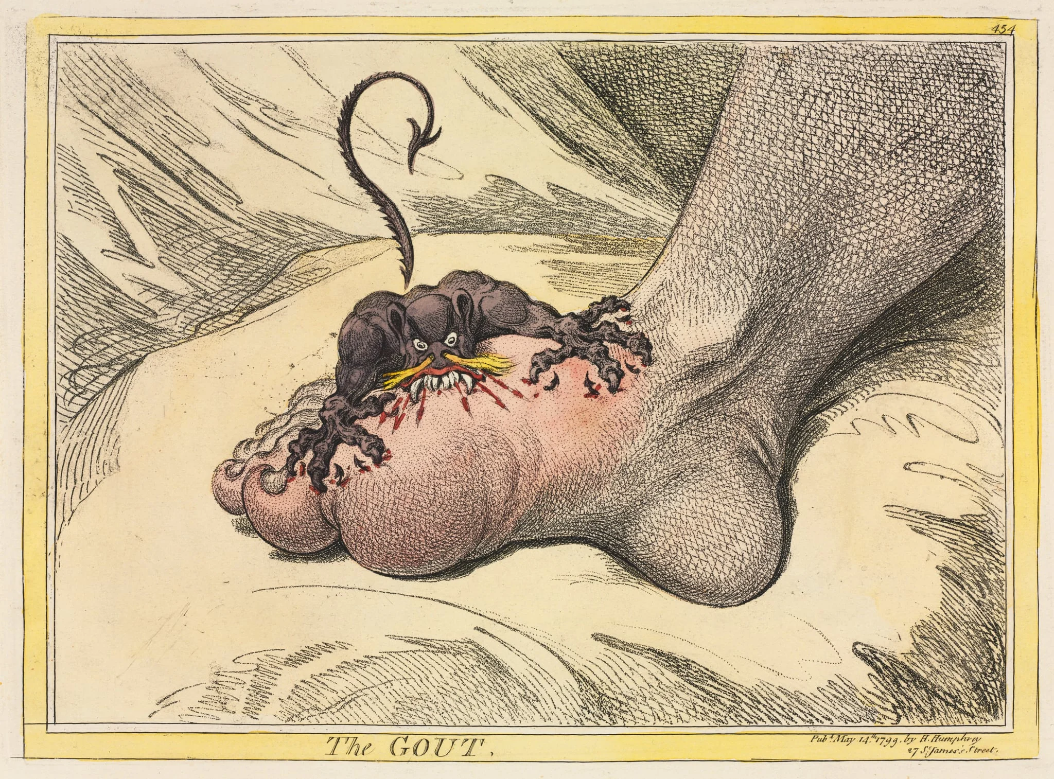 The Gout, detail
