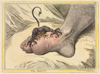 The Gout, by James Gillray, 1799