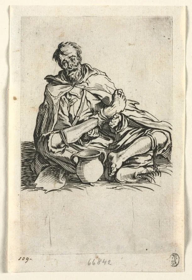 The Beggars: Malingerer, detail