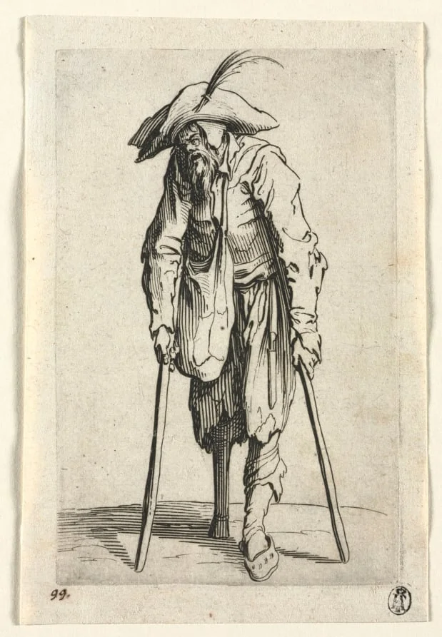 The Beggars: Beggar with Wooden Leg, detail