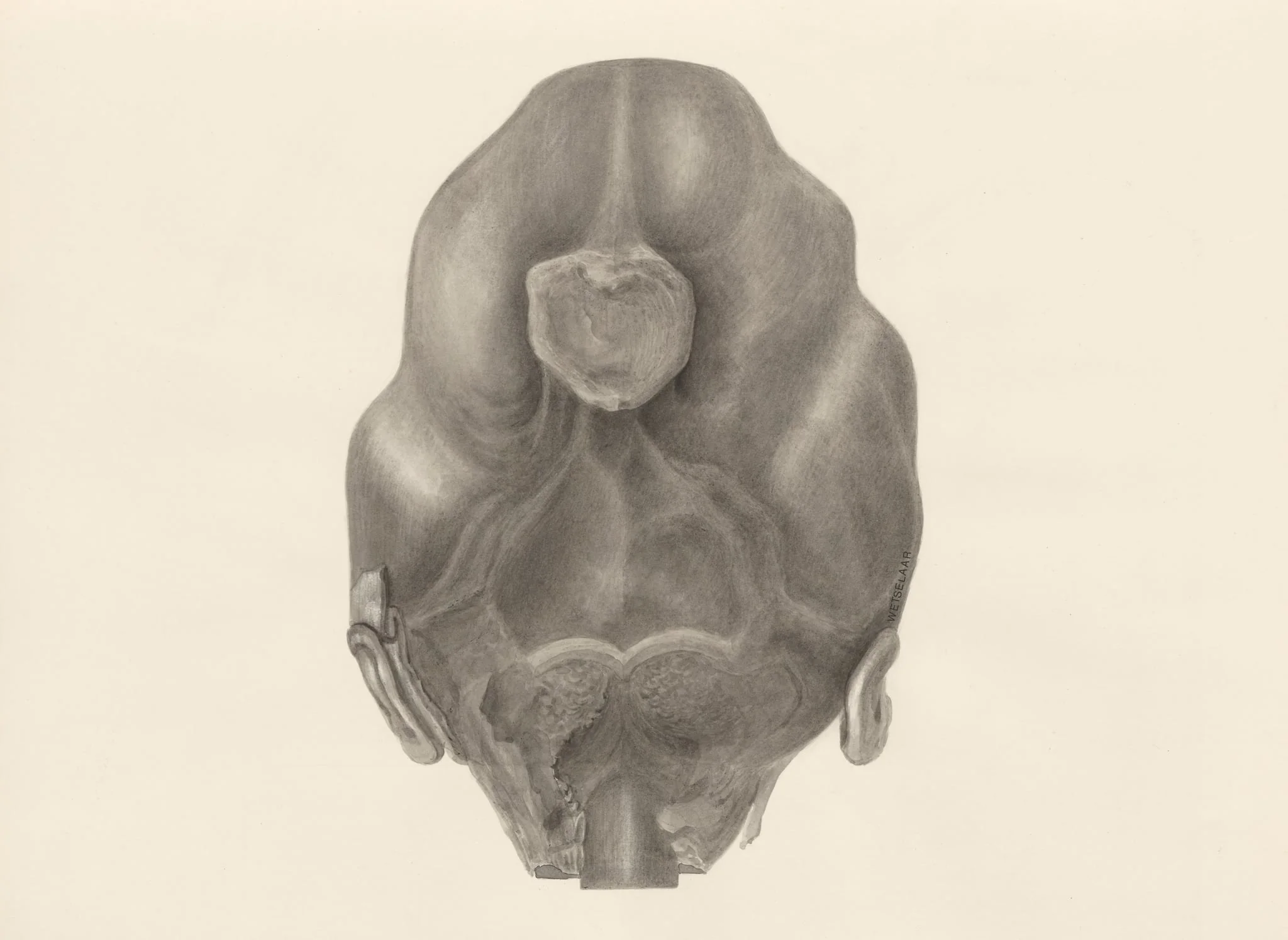 Deformed fetal head, seen from the back, detail