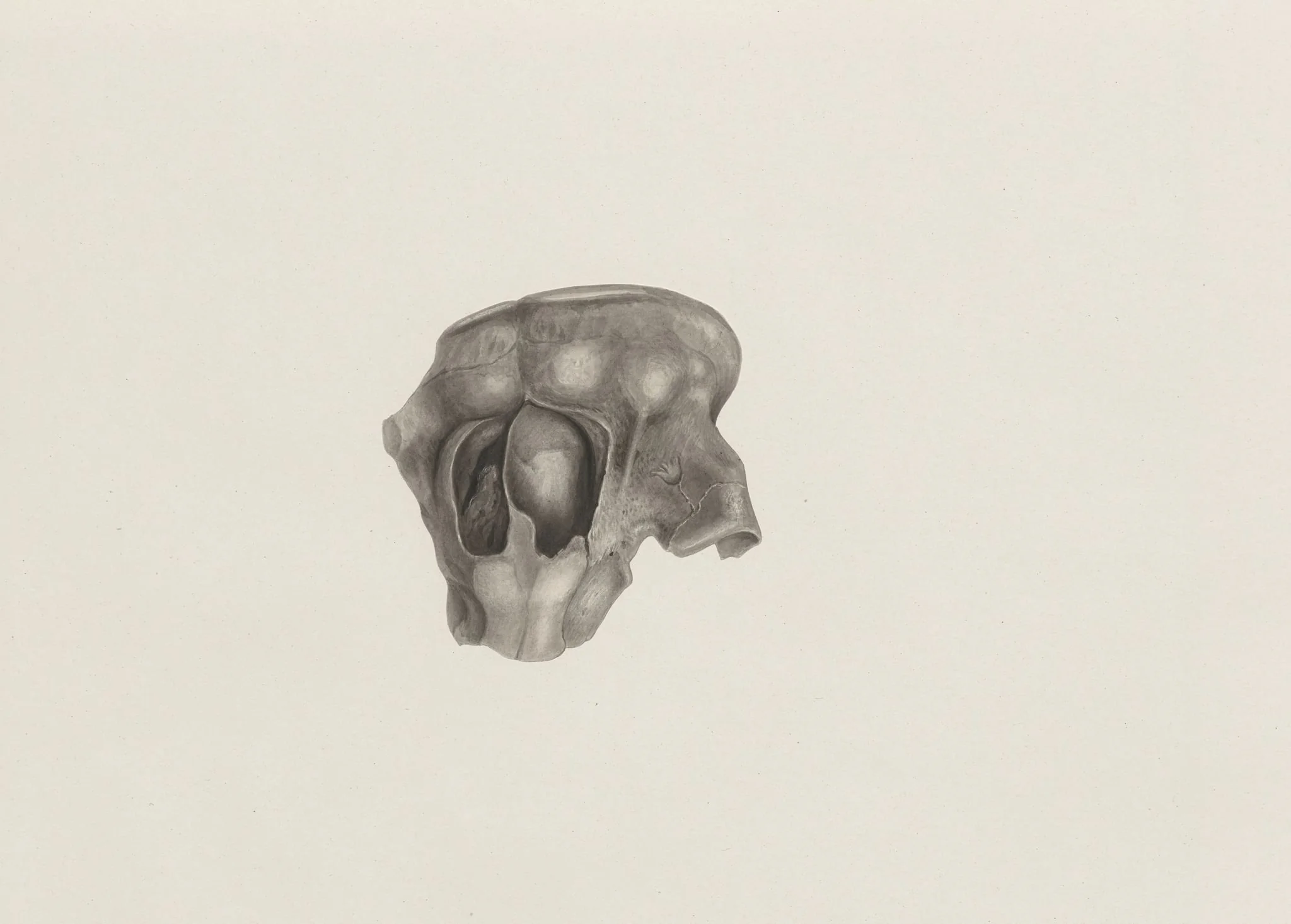 Part of a deformed fetal head, detail