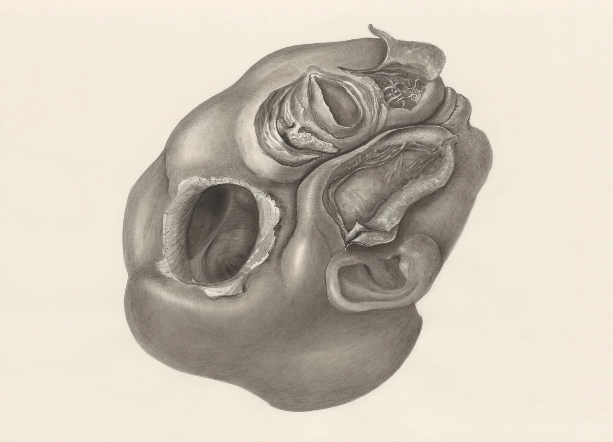 Deformed fetal head, lateral view, detail