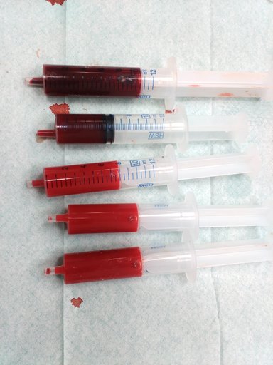 Portrait of Blood