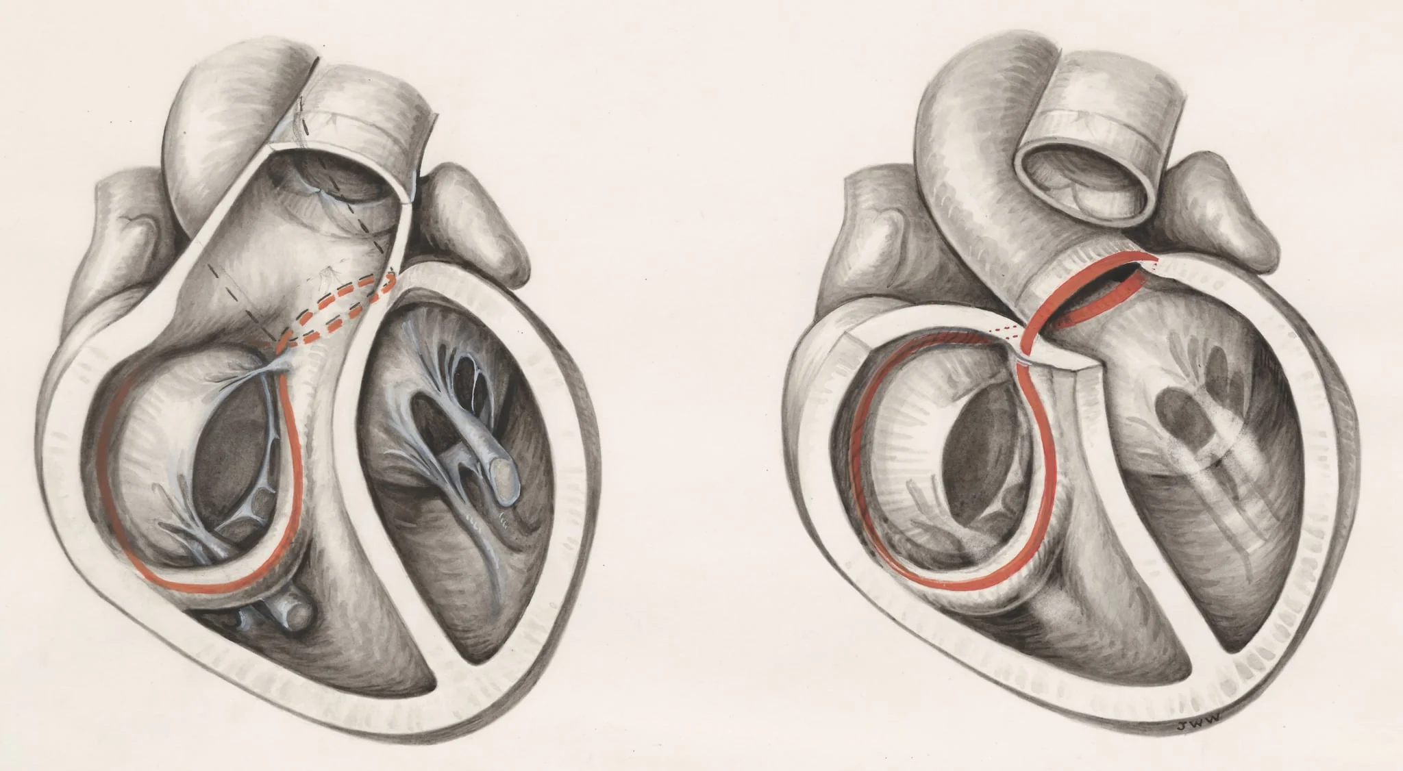 Two cross sections of the human heart, detail