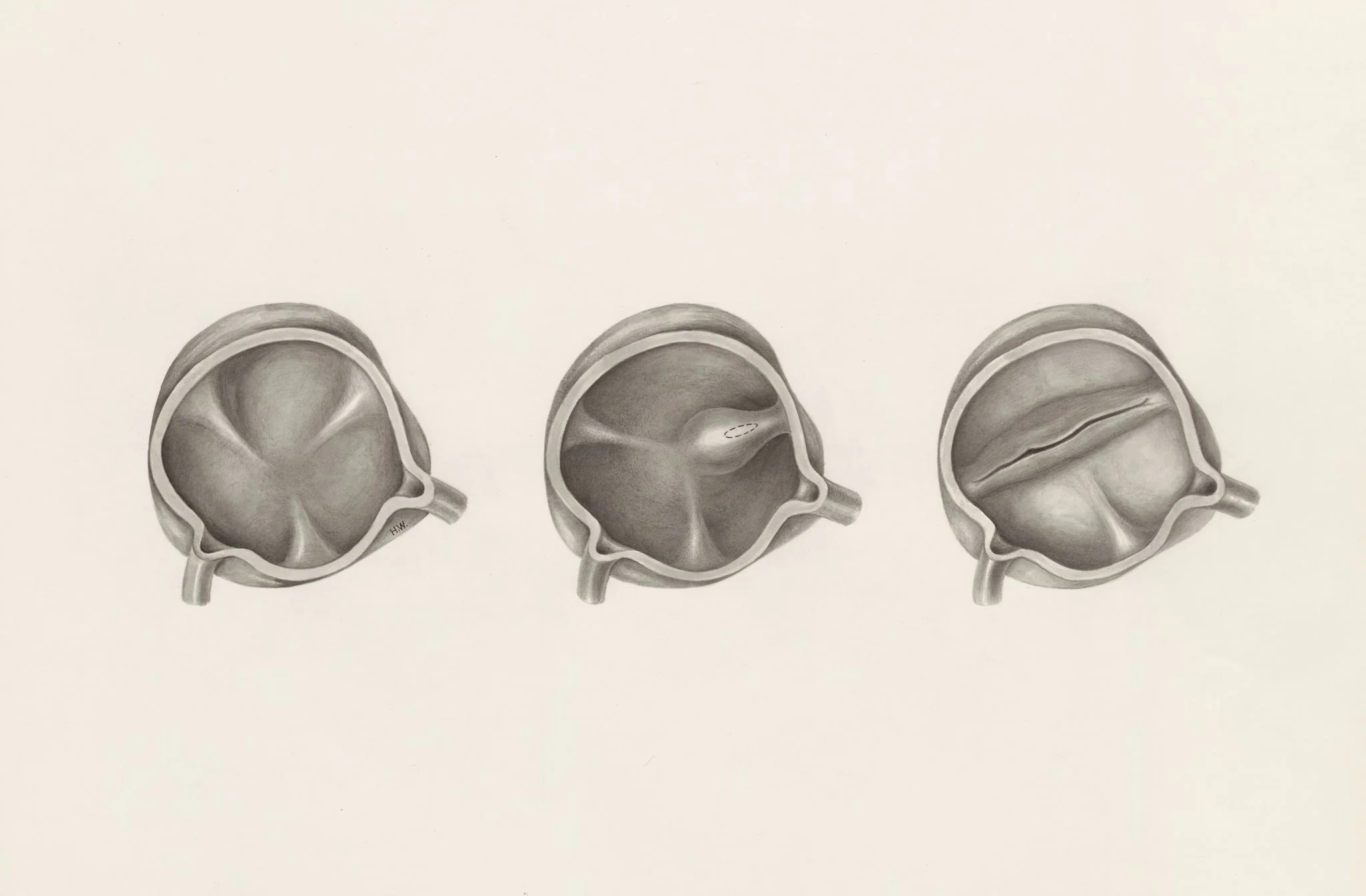 Cross section of the cardiovascular system, detail