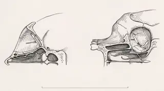 Cross section of the palate and/or nasal cavity of a human and a mammal, 1970