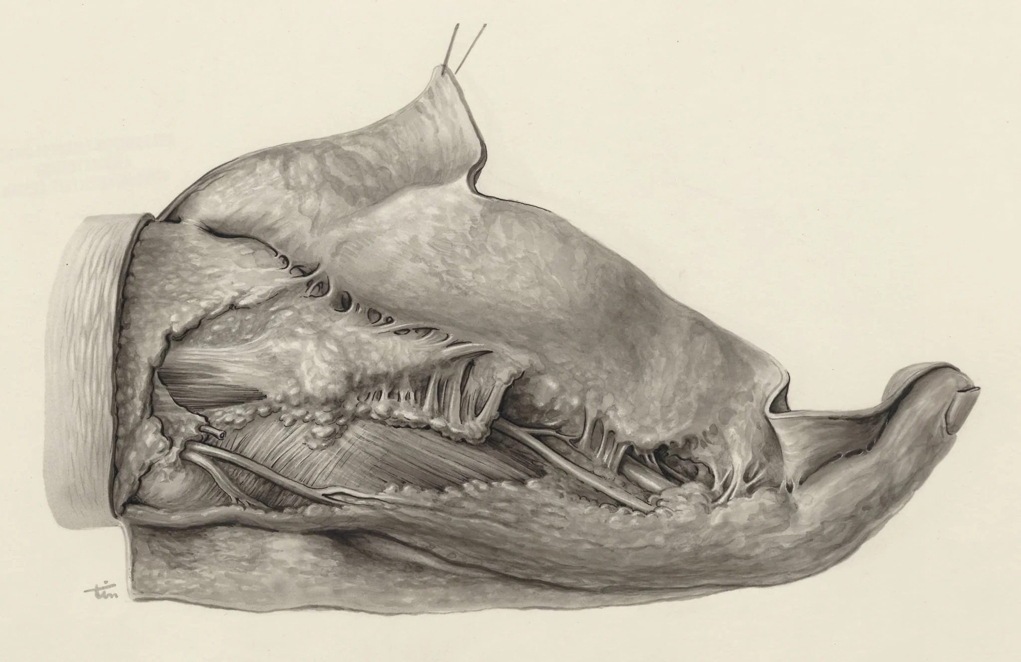 Muscular tissue of the hand and finger, detail