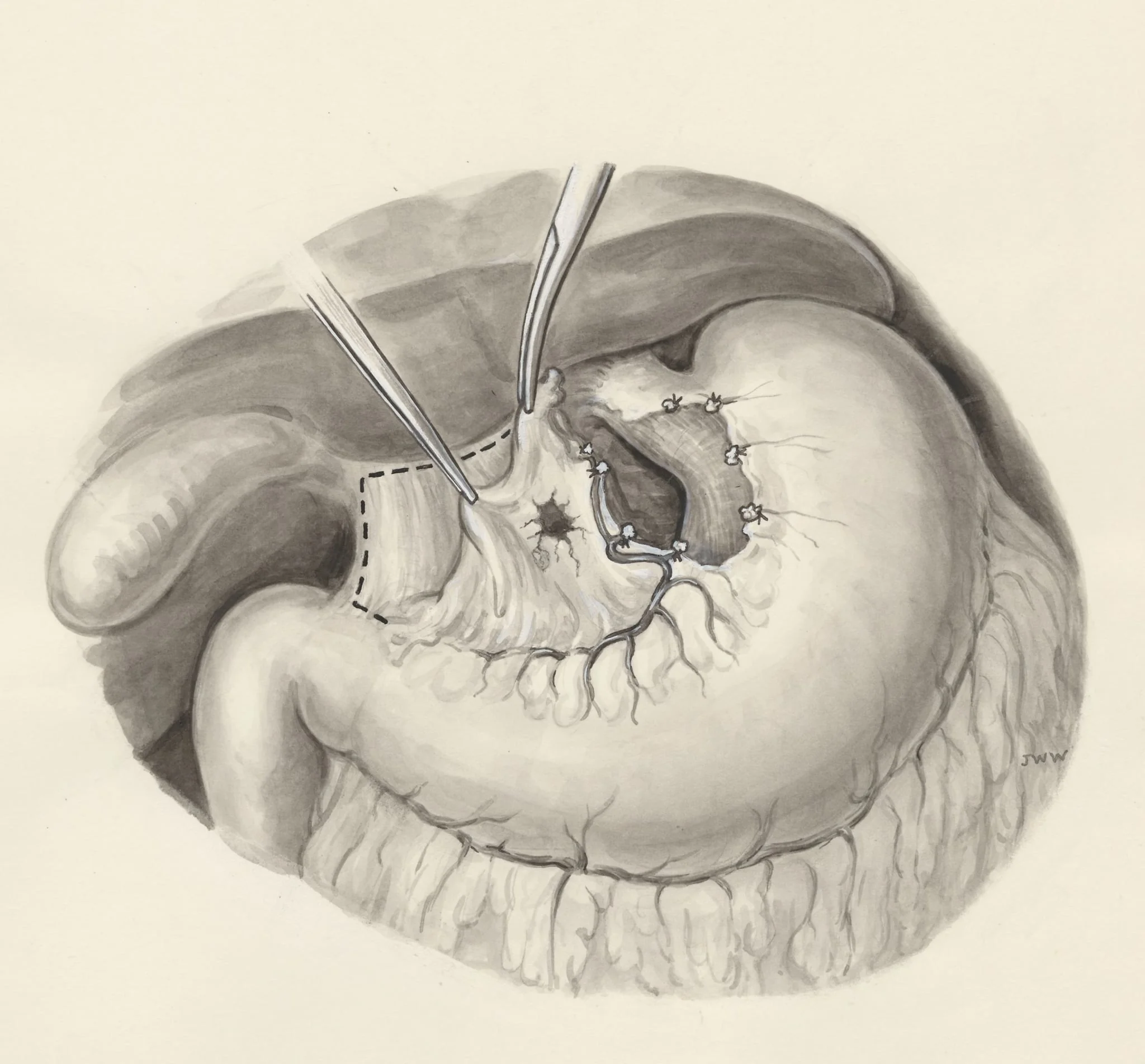 Surgery on a part of the human body, detail