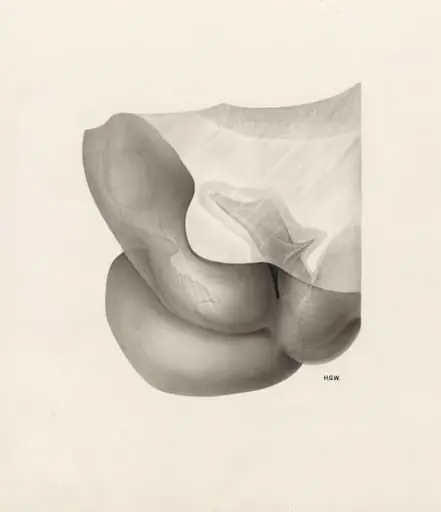 Embryonic tissue, by H.G, Wetselaar