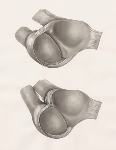 Joints of the hand or fingers, by H.G, Wetselaar