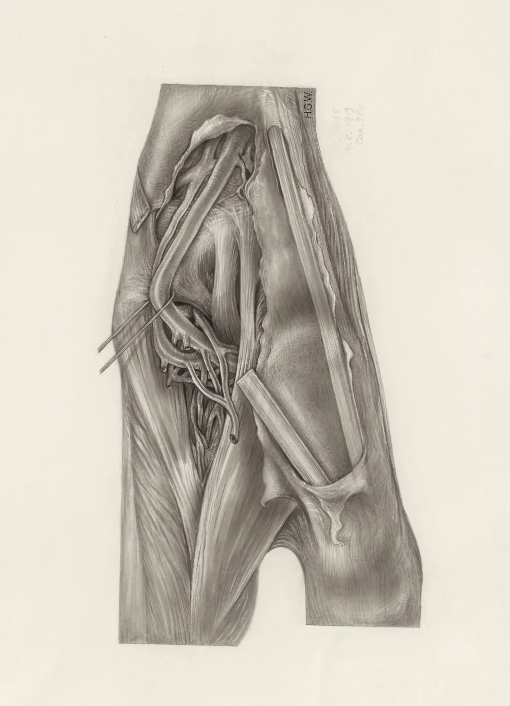 Muscular tissue of the upper extremities, by H.G, Wetselaar, 1971