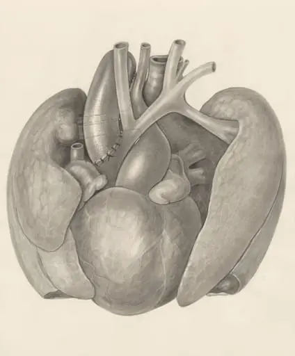 Surgical procedure on a heart and adjacent organs, by H.G, Wetselaar