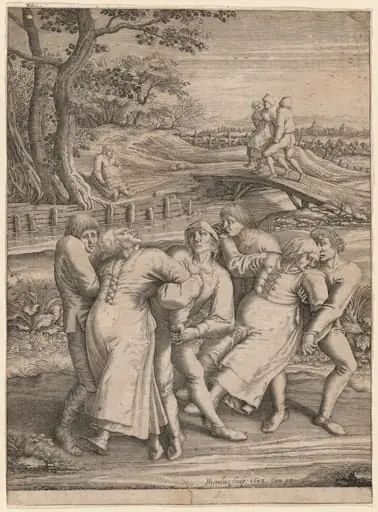 Epileptics Walking to the Left