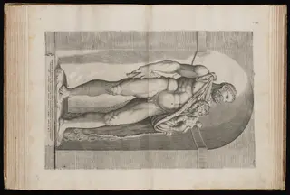 Heracles with the Infant Telephos