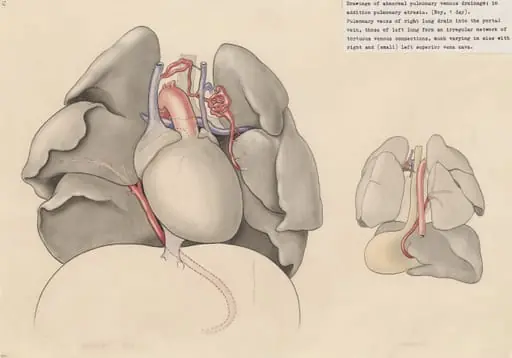 Heart and adjacent organs, by J Tinkelenberg