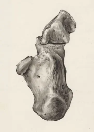 Musculoskeletal system of the foot, by J Tinkelenberg