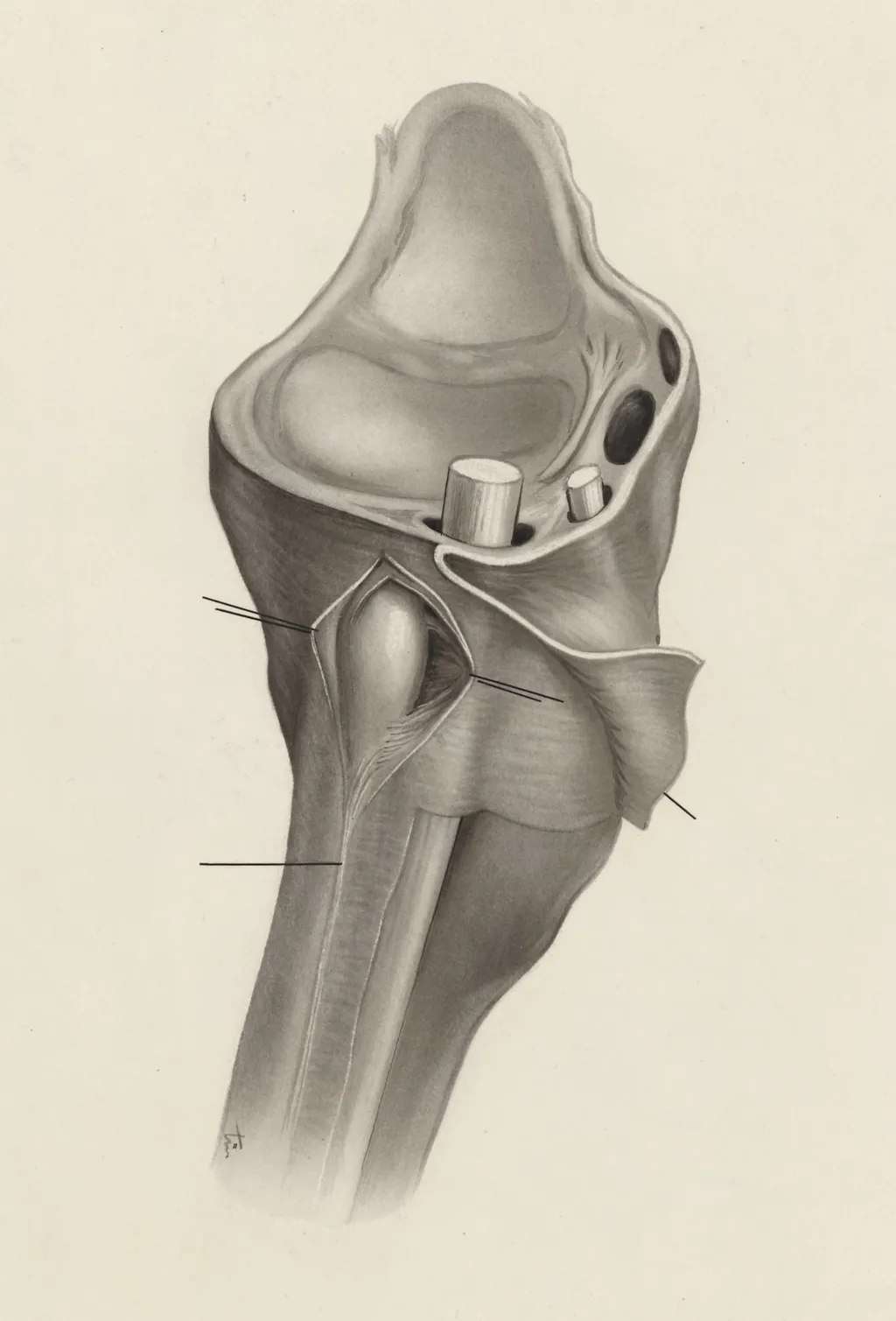 Musculoskeletal system of the wrist, by J Tinkelenberg, 1970