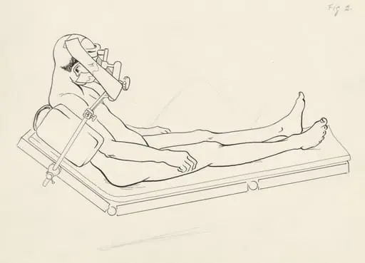 Neurosurgical Procedures