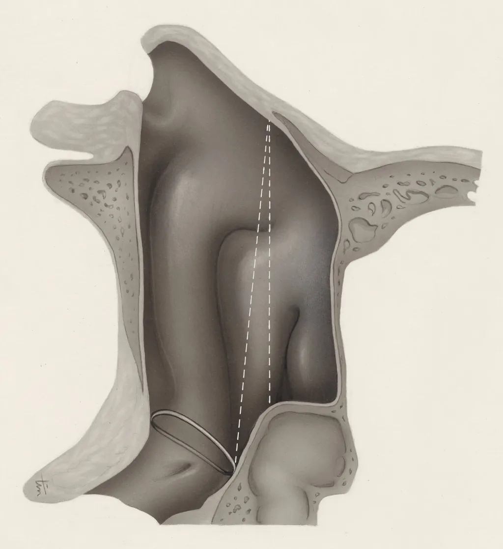 Respiratory system, by J Tinkelenberg, unspecified, 1970