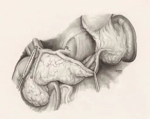Operation on human tissue, by J Wetselaar-Whittaker