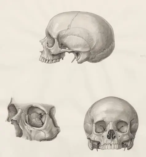 Skull seen from three sides, by J Wetselaar-Whittaker