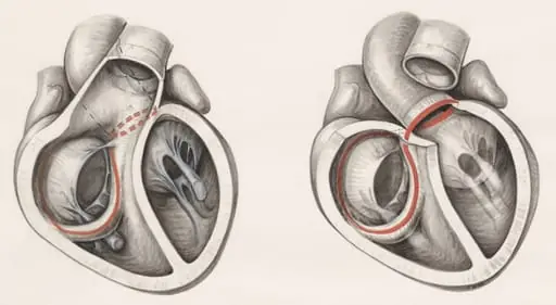 Two cross sections of the human heart