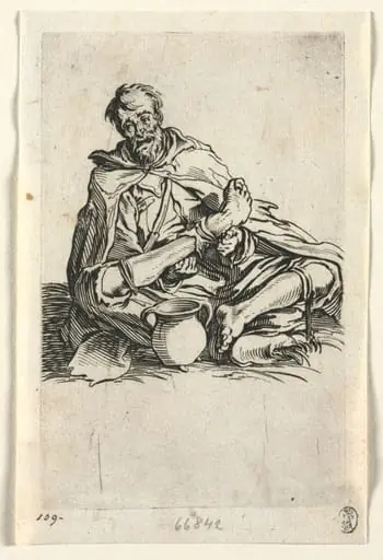 The Beggars: Malingerer, by Jacques Callot