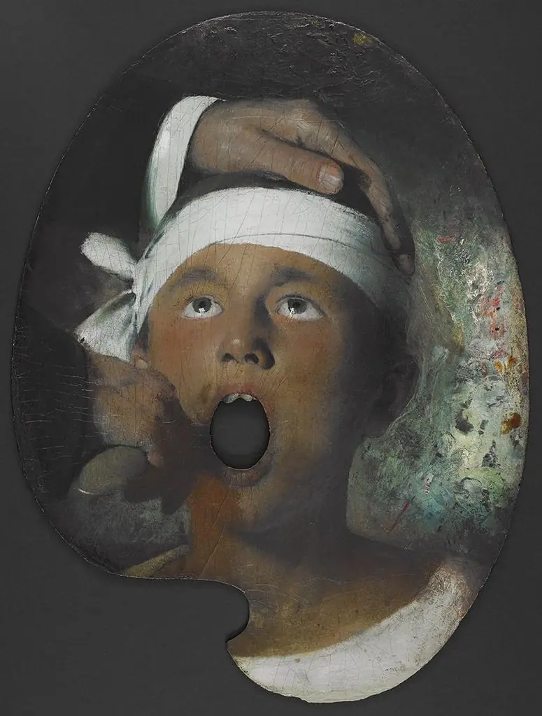 Boy at the Dentist, by Joseph Decker
