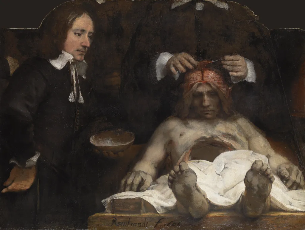 The anatomy lesson of Dr. Joan Deijman, by Rembrandt, oil, 1656
