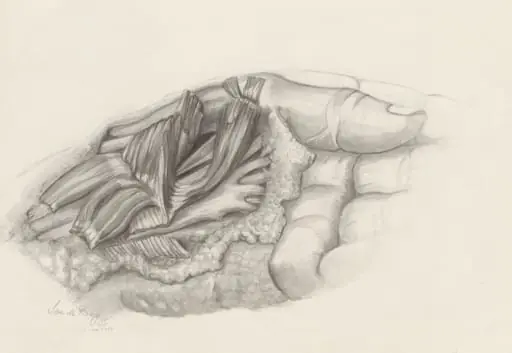 Musculoskeletal system of the upper extremity, by S. v.d Berg