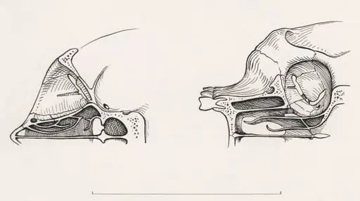 Cross section of the palate and/or nasal cavity of a human and a mammal, by Unknown