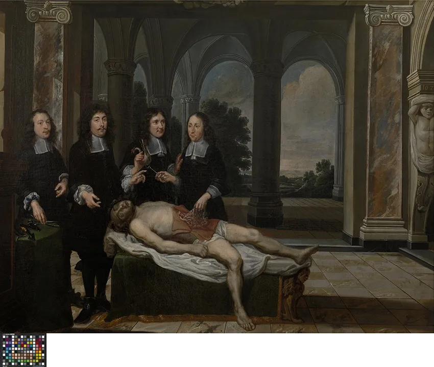 De anatomische les, by Unknown, oil, 1690