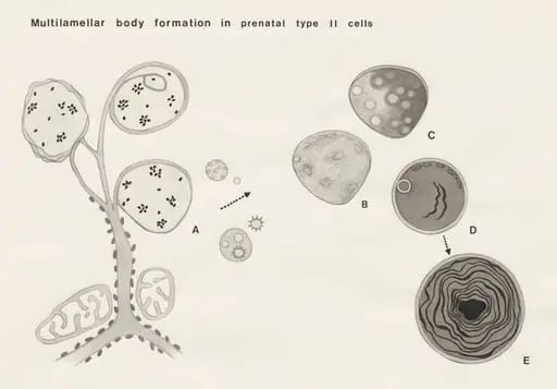Multilamellar body formation in prenatal type II cells, by Unknown