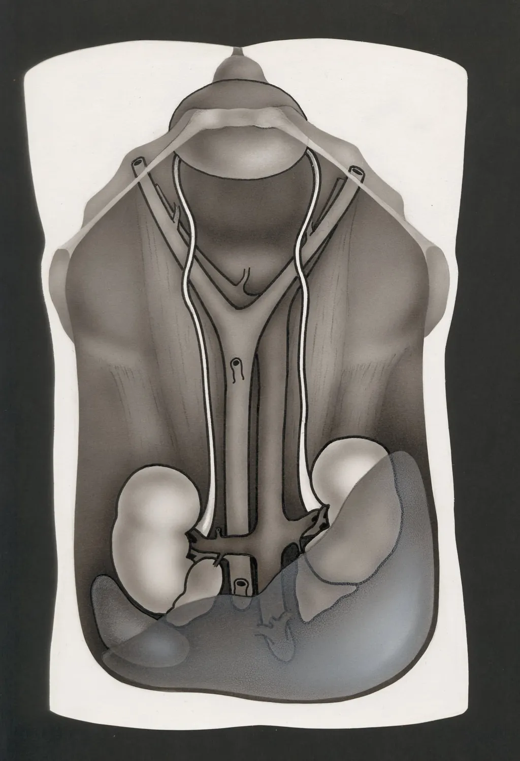 Opened abdominal cavity, with the kidneys, by Unknown, 1970