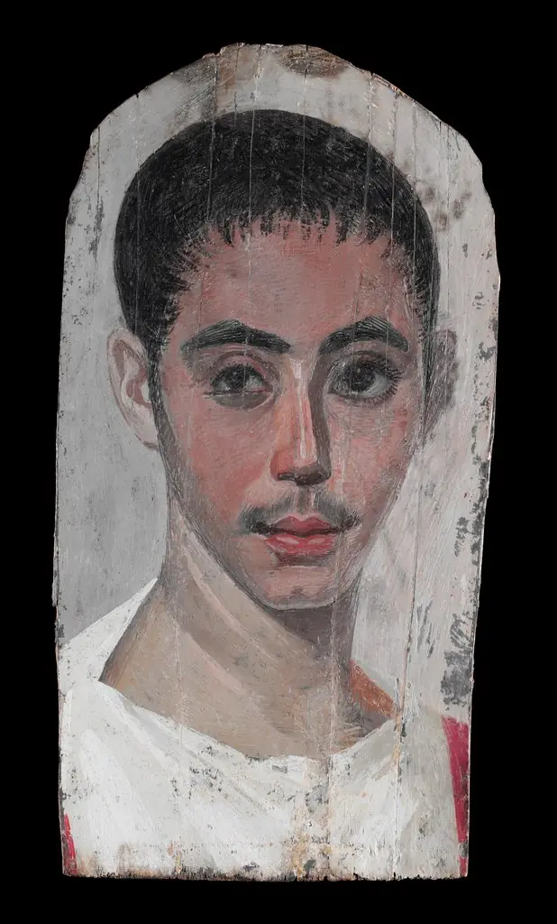 Portrait of a Youth with a Surgical Cut in one Eye, by Unknown