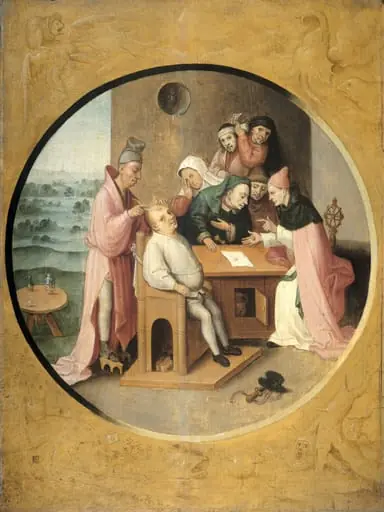 'Removing the Rocks in the Head', by Unknown