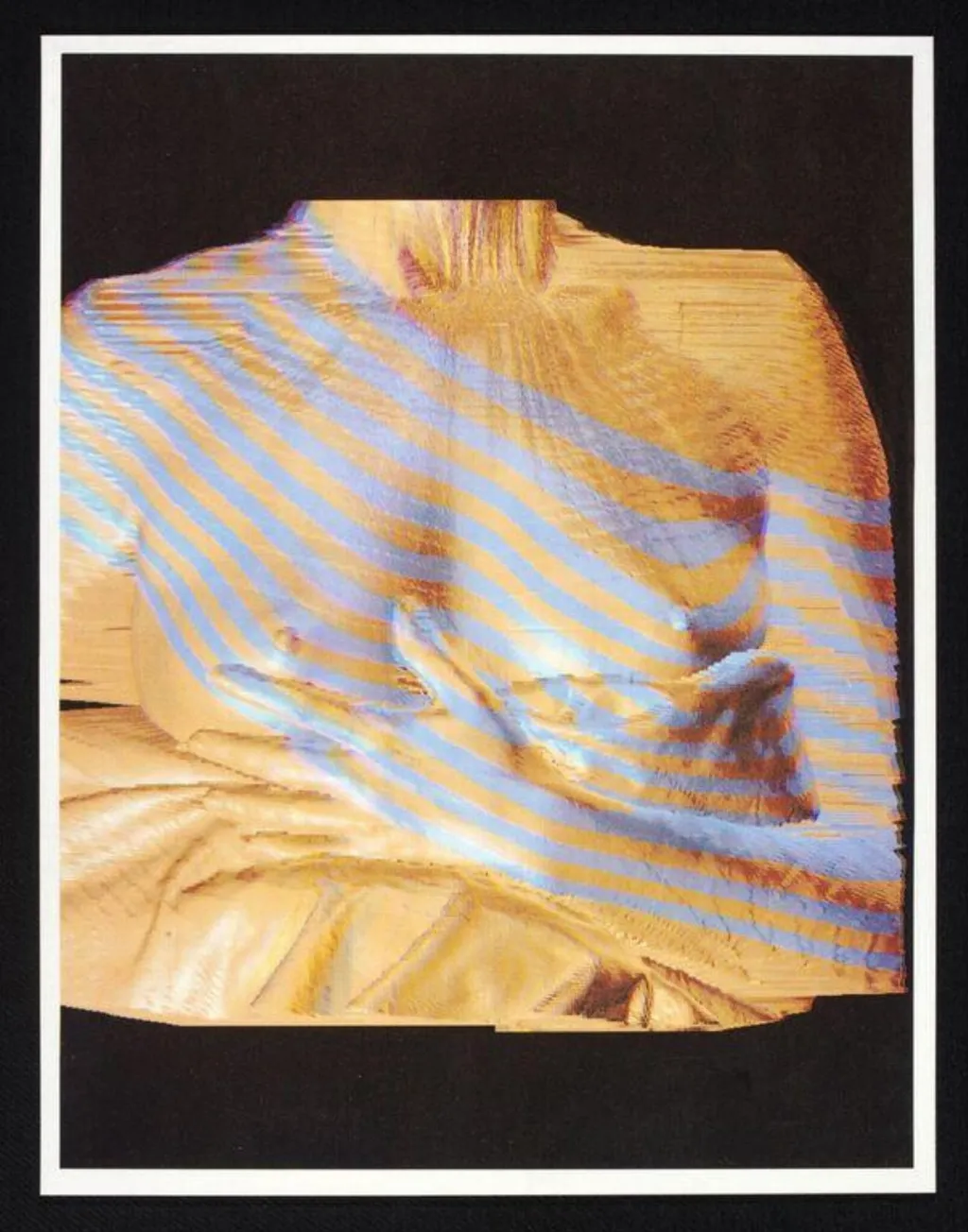 Virtual Implants, by Unknown, 1990